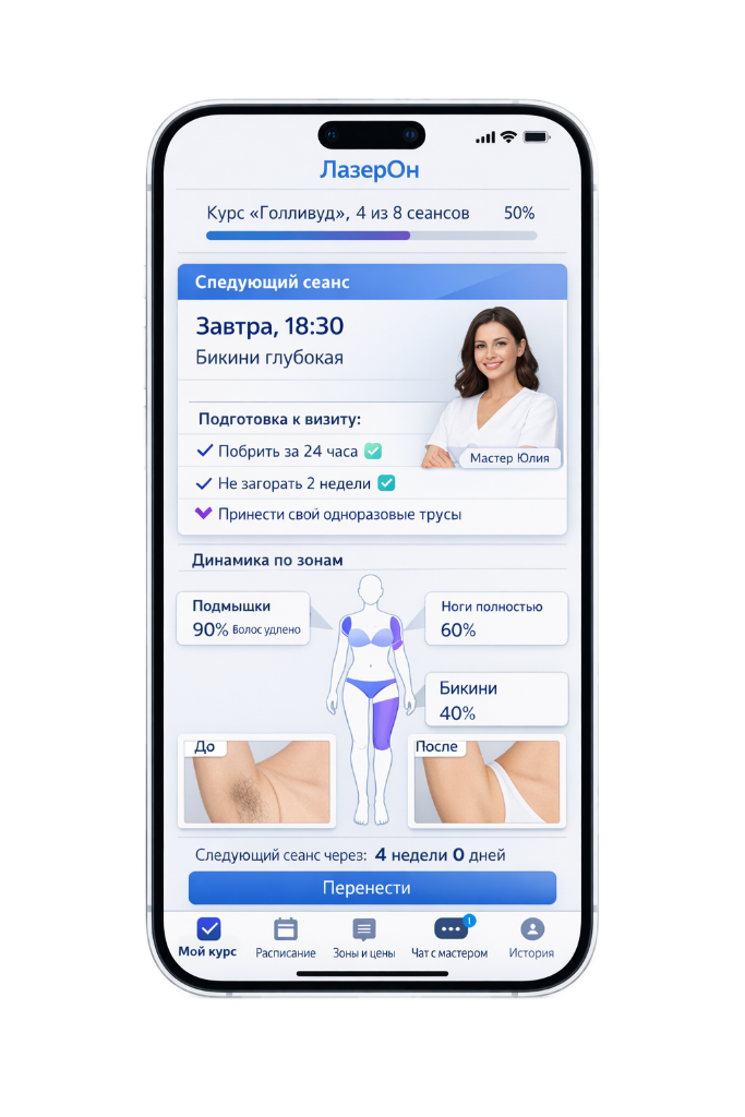 Лазерная эпиляция